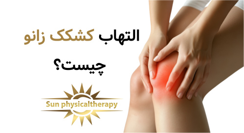 التهاب کشکک زانو چیست