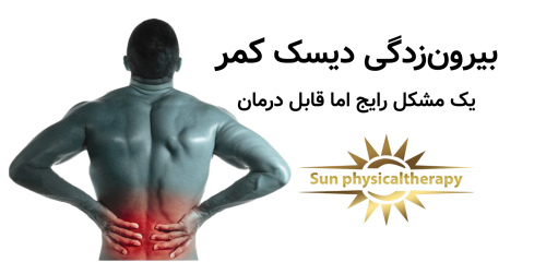 بیرون‌زدگی دیسک کمر یک مشکل رایج اما قابل درمان است.