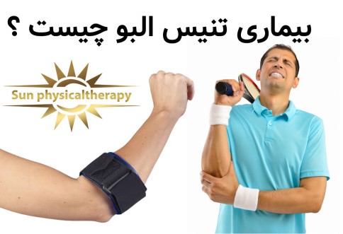 بیماری تنیس البو چیست