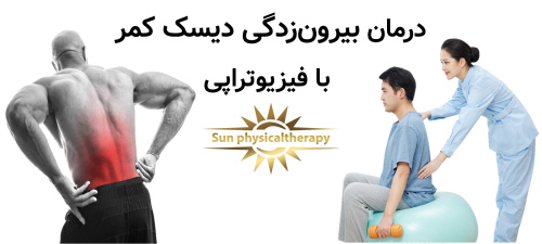 درمان بیرون‌زدگی دیسک کمر با فیزیوتراپی؛ روشی ایمن و مؤثر برای کاهش درد