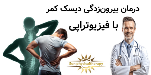 درمان بیرون‌زدگی دیسک کمر با فیزیوتراپی؛ روشی ایمن و مؤثر
