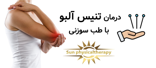 درمان تنیس آلبو با طب سوزنی