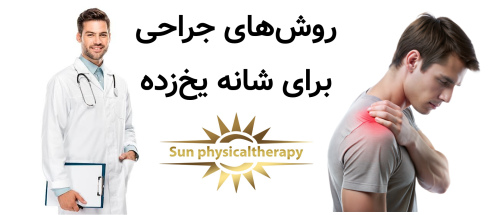 روش‌های جراحی برای شانه یخ‌زده