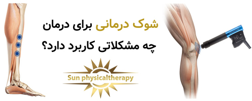 شوک درمانی برای درمان چه مشکلاتی کاربرد دارد؟