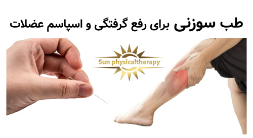 طب سوزنی برای رفع گرفتگی و اسپاسم عضلات