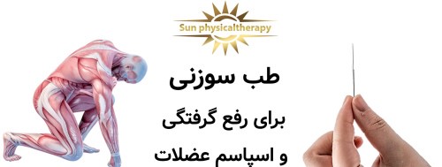 طب سوزنی برای رفع گرفتگی و اسپاسم