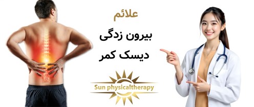 علائم بیرون زدگی دیسک کمر