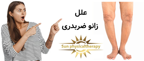علل زانو ضربدری