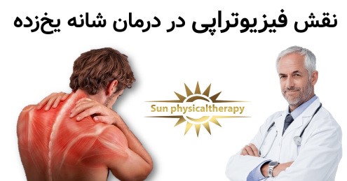 نقش فیزیوتراپی در درمان شانه یخ‌زده