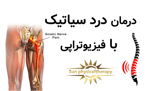 درمان درد سیاتیک با فیزیوتراپی