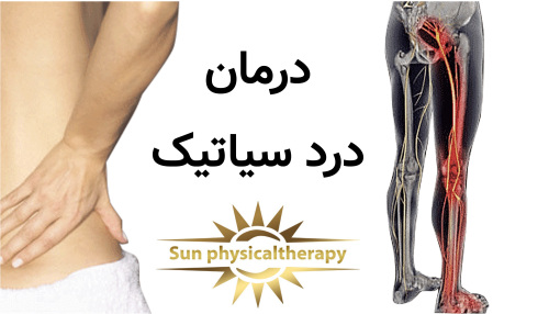 درمان درد سیاتیک